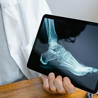 Physiotherapeut mit Röntgenbild - Chirurgie & Orthopädie